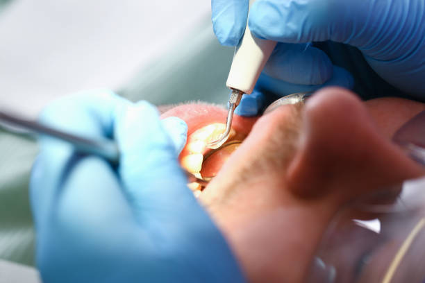 Best After-Hours Emergency Dentist in Lyndhurst, VA