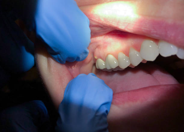 Best Emergency Orthodontic Repairs in Lyndhurst, VA